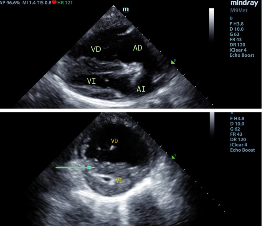 Ecocardiografia Doppler